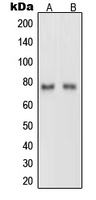 NTN1 / Netrin 1 Antibody - Western blot analysis of Netrin 1 expression in rat brain (A); PC12 (B) whole cell lysates.