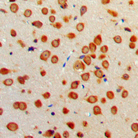 NTN1 / Netrin 1 Antibody - Immunohistochemical analysis of Netrin 1 staining in human brain formalin fixed paraffin embedded tissue section. The section was pre-treated using heat mediated antigen retrieval with sodium citrate buffer (pH 6.0). The section was then incubated with the antibody at room temperature and detected using an HRP conjugated compact polymer system. DAB was used as the chromogen. The section was then counterstained with hematoxylin and mounted with DPX.