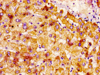 NTN1 / Netrin 1 Antibody - Immunohistochemistry image at a dilution of 1:400 and staining in paraffin-embedded human liver tissue performed on a Leica BondTM system. After dewaxing and hydration, antigen retrieval was mediated by high pressure in a citrate buffer (pH 6.0) . Section was blocked with 10% normal goat serum 30min at RT. Then primary antibody (1% BSA) was incubated at 4 °C overnight. The primary is detected by a biotinylated secondary antibody and visualized using an HRP conjugated SP system.