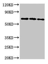 NTN1 / Netrin 1 Antibody - Western Blot Positive WB detected in: 293T whole cell lysate, Hela whole cell lysate, HepG2 whole cell lysate All lanes: NTN1 antibody at 6.4µg/ml Secondary Goat polyclonal to rabbit IgG at 1/50000 dilution Predicted band size: 68 kDa Observed band size: 68 kDa
