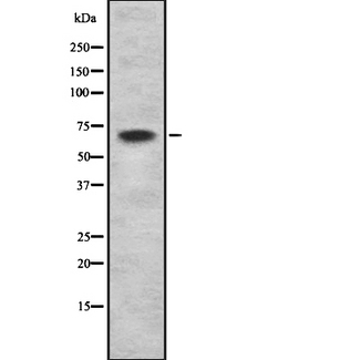 NTN1 / Netrin 1 Antibody - Western blot analysis Netrin-1 using LOVO cells whole cells lysates