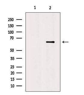 NTN1 / Netrin 1 Antibody - Western blot analysis of extracts of mouse brain tissue using Netrin-1 antibody. Lane 1 was treated with the antigen-specific peptide.