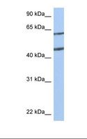 NTN4 / Netrin 4 Antibody - MCF7 cell lysate. Antibody concentration: 1.0 ug/ml. Gel concentration: 12%.  This image was taken for the unconjugated form of this product. Other forms have not been tested.