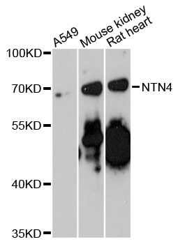 NTN4 / Netrin 4 Antibody - Western blot analysis of extracts of various cell lines, using NTN4 antibody at 1:3000 dilution. The secondary antibody used was an HRP Goat Anti-Rabbit IgG (H+L) at 1:10000 dilution. Lysates were loaded 25ug per lane and 3% nonfat dry milk in TBST was used for blocking. An ECL Kit was used for detection and the exposure time was 90s.