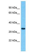 NTN5 Antibody - NTN5 antibody Western Blot of HCT15. Antibody dilution: 1 ug/ml.  This image was taken for the unconjugated form of this product. Other forms have not been tested.