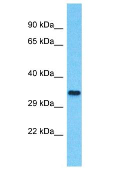 NTN5 Antibody - NTN5 antibody Western Blot of HCT15. Antibody dilution: 1 ug/ml.  This image was taken for the unconjugated form of this product. Other forms have not been tested.