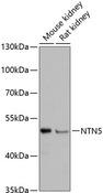 NTN5 Antibody - Western blot analysis of extracts of various cell lines using NTN5 Polyclonal Antibody at dilution of 1:3000.