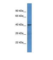 NTNG1 / Netrin G1 Antibody - Western blot of Human U937. NTNG1 antibody dilution 1.0 ug/ml.  This image was taken for the unconjugated form of this product. Other forms have not been tested.