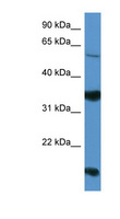 NTNG2 / Netrin G2 Antibody - NTNG2 / Netrin G2 antibody Western blot of HepG2 cell lysate.  This image was taken for the unconjugated form of this product. Other forms have not been tested.