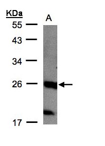 NTPCR / C1orf57 Antibody - Sample (30 ug of whole cell lysate). A: MOLT4. 12% SDS PAGE. NTPCR / C1orf57 antibody diluted at 1:1000