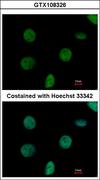 NTPCR / C1orf57 Antibody - Immunofluorescence of paraformaldehyde-fixed HeLa using C1orf57 antibody at 1:500 dilution.
