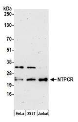 NTPCR / C1orf57 Antibody - Detection of human NTPCR by western blot. Samples: Whole cell lysate (15 µg) from HeLa, HEK293T, and Jurkat cells prepared using NETN lysis buffer. Antibody: Affinity purified rabbit anti-NTPCR antibody used for WB at 1:1000. Detection: Chemiluminescence with an exposure time of 3 minutes.
