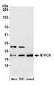 NTPCR / C1orf57 Antibody - Detection of human NTPCR by western blot. Samples: Whole cell lysate (15 µg) from HeLa, HEK293T, and Jurkat cells prepared using NETN lysis buffer. Antibody: Affinity purified rabbit anti-NTPCR antibody used for WB at 1:1000. Detection: Chemiluminescence with an exposure time of 3 minutes.