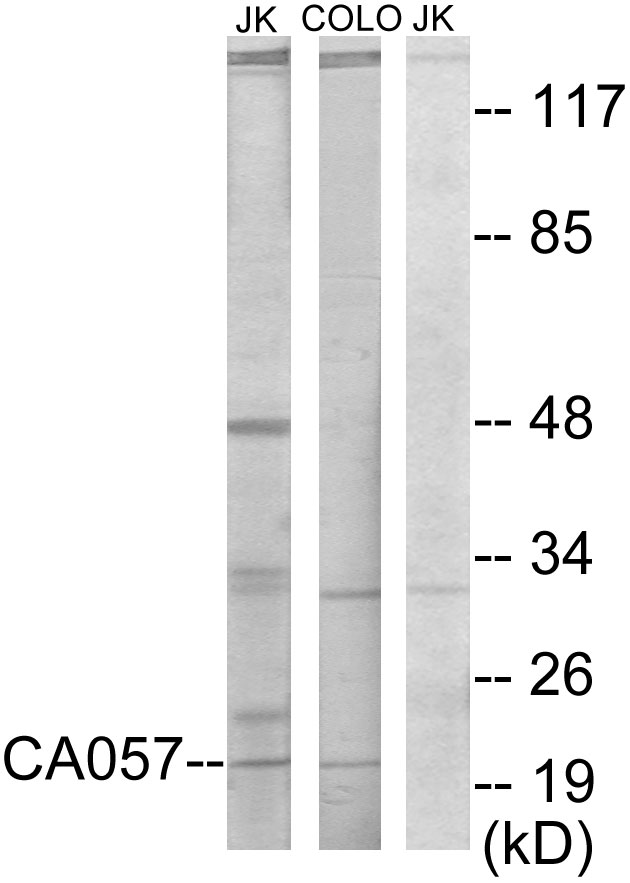 NTPCR / C1orf57 Antibody - Western blot analysis of lysates from Jurkat and COLO205 cells, using C1orf57 Antibody. The lane on the right is blocked with the synthesized peptide.