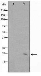 NTPCR / C1orf57 Antibody - Western blot of Jurkat cell lysate using C1orf57 Antibody