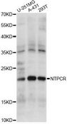 NTPCR / C1orf57 Antibody - Western blot analysis of extracts of various cell lines, using NTPCR antibody at 1:1000 dilution. The secondary antibody used was an HRP Goat Anti-Rabbit IgG (H+L) at 1:10000 dilution. Lysates were loaded 25ug per lane and 3% nonfat dry milk in TBST was used for blocking. An ECL Kit was used for detection and the exposure time was 10s.