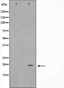 NTPCR / C1orf57 Antibody - Western blot analysis on Jurkat cell lysates using C1orf57 antibody