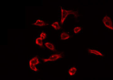 NTPCR / C1orf57 Antibody - Staining HeLa cells by IF/ICC. The samples were fixed with PFA and permeabilized in 0.1% Triton X-100, then blocked in 10% serum for 45 min at 25°C. The primary antibody was diluted at 1:200 and incubated with the sample for 1 hour at 37°C. An Alexa Fluor 594 conjugated goat anti-rabbit IgG (H+L) Ab, diluted at 1/600, was used as the secondary antibody.