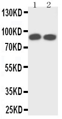 NTRK1 / TrkA Antibody - TrkA antibody Western blot. Lane 1: Rat Brain Tissue Lysate. Lane 2: Mouse Brain Tissue Lysate.
