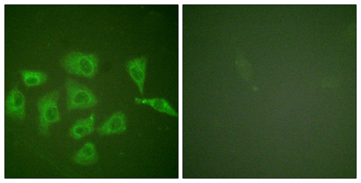 NTRK1 / TrkA Antibody - Immunofluorescence analysis of HUVEC cells, using Trk A Antibody. The picture on the right is blocked with the synthesized peptide.