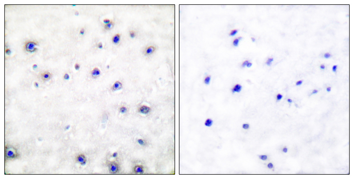 NTRK1 / TrkA Antibody - Immunohistochemistry analysis of paraffin-embedded human brain tissue, using Trk A Antibody. The picture on the right is blocked with the synthesized peptide.