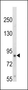 NTRK1 / TrkA Antibody - Western blot of hTrkA-pY791 in HepG2 cell line lysates (35 ug/lane). TRK (arrow) was detected using the purified antibody.