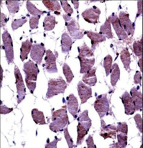 NTRK1 / TrkA Antibody - TrkA-pY791 Antibody immunohistochemistry of formalin-fixed and paraffin-embedded human skeletal muscle followed by peroxidase-conjugated secondary antibody and DAB staining.