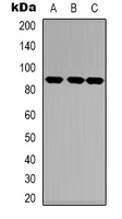 NTRK1 / TrkA Antibody - Western blot analysis of TRK A expression in HEK293T (A); NIH3T3 (B); mouse heart (C) whole cell lysates.