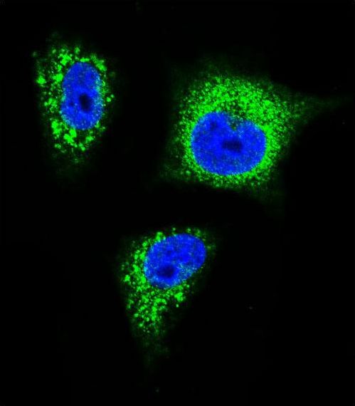 NTRK1 / TrkA Antibody - Confocal immunofluorescence of TrkA Antibody with MDA-MB231 cell followed by Alexa Fluor 488-conjugated goat anti-rabbit lgG (green). DAPI was used to stain the cell nuclear (blue).