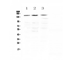 NTRK1 / TrkA Antibody - Western blot analysis of TrkA using anti-TrkA antibody