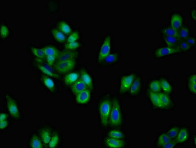 NTRK1 / TrkA Antibody - Immunofluorescent analysis of HepG2 cells at a dilution of 1:100 and Alexa Fluor 488-congugated AffiniPure Goat Anti-Rabbit IgG(H+L)