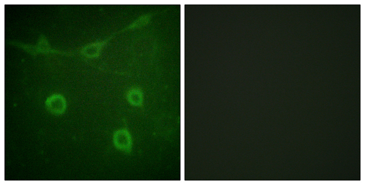 NTRK1 / TrkA Antibody - Immunofluorescence analysis of NIH/3T3 cells, using Trk A (Phospho-Tyr496) Antibody. The picture on the right is blocked with the phospho peptide.
