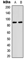 NTRK1 / TrkA Antibody - Western blot analysis of TRK A (pY496) expression in mouse brain (A); rat brain (B) whole cell lysates.