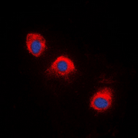 NTRK1 / TrkA Antibody - Immunofluorescent analysis of TRK A (pY496) staining in NIH3T3 cells. Formalin-fixed cells were permeabilized with 0.1% Triton X-100 in TBS for 5-10 minutes and blocked with 3% BSA-PBS for 30 minutes at room temperature. Cells were probed with the primary antibody in 3% BSA-PBS and incubated overnight at 4 deg C in a humidified chamber. Cells were washed with PBST and incubated with a DyLight 594-conjugated secondary antibody (red) in PBS at room temperature in the dark. DAPI was used to stain the cell nuclei (blue).