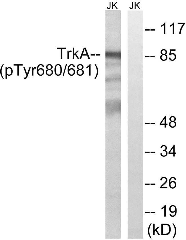 NTRK1 / TrkA Antibody - Western blot analysis of lysates from Jurkat cells treated with starved 24h, using Trk A (Phospho-Tyr680+Tyr681) Antibody. The lane on the right is blocked with the phospho peptide.