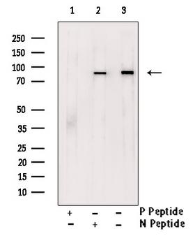 NTRK1 / TrkA Antibody - Western blot analysis of Phospho-Trk A (Tyr680+Tyr681) antibody expression in starved treated JK cells lysates. The lane on the right is treated with the antigen-specific peptide.