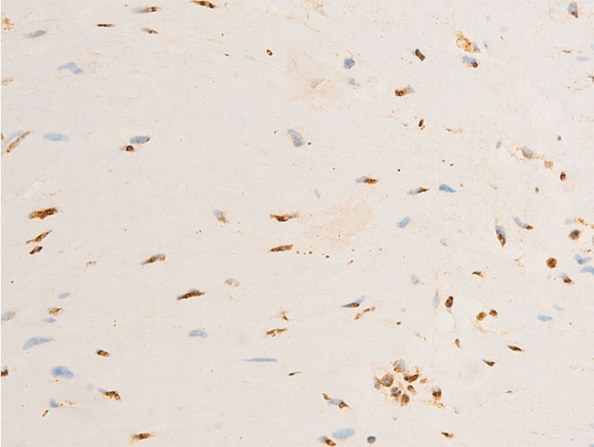 NTRK1 / TrkA Antibody - 1:100 staining human heart tissue by IHC-P. The tissue was formaldehyde fixed and a heat mediated antigen retrieval step in citrate buffer was performed. The tissue was then blocked and incubated with the antibody for 1.5 hours at 22°C. An HRP conjugated goat anti-rabbit antibody was used as the secondary.