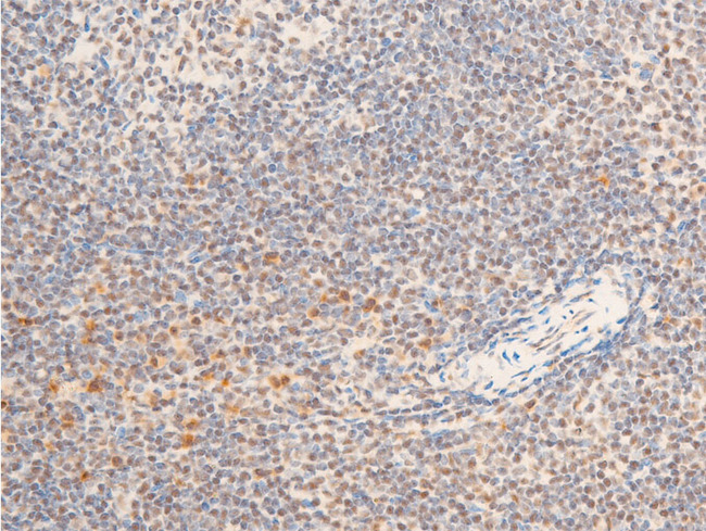 NTRK1 / TrkA Antibody - 1:100 staining mouse spleen tissue by IHC-P. The tissue was formaldehyde fixed and a heat mediated antigen retrieval step in citrate buffer was performed. The tissue was then blocked and incubated with the antibody for 1.5 hours at 22°C. An HRP conjugated goat anti-rabbit antibody was used as the secondary.