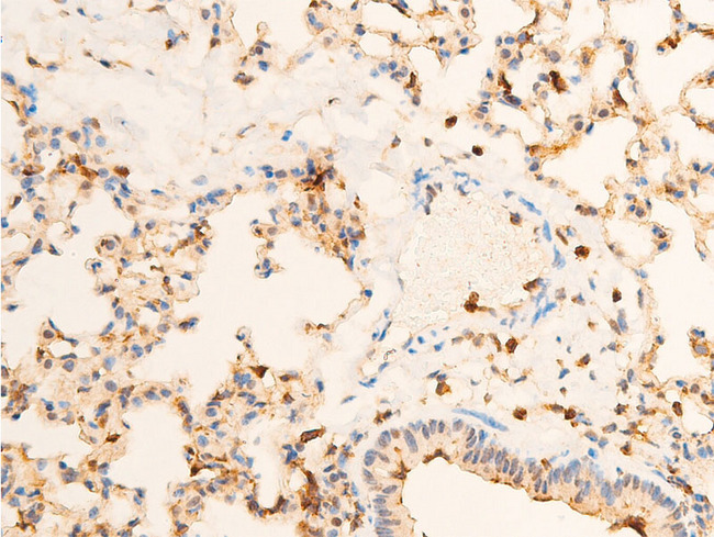 NTRK1 / TrkA Antibody - 1:100 staining mouse lung tissue by IHC-P. The tissue was formaldehyde fixed and a heat mediated antigen retrieval step in citrate buffer was performed. The tissue was then blocked and incubated with the antibody for 1.5 hours at 22°C. An HRP conjugated goat anti-rabbit antibody was used as the secondary.