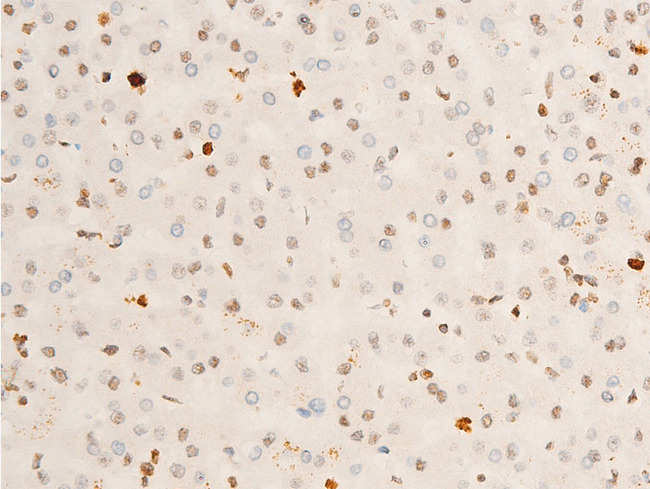 NTRK1 / TrkA Antibody - 1:100 staining human liver tissue by IHC-P. The tissue was formaldehyde fixed and a heat mediated antigen retrieval step in citrate buffer was performed. The tissue was then blocked and incubated with the antibody for 1.5 hours at 22°C. An HRP conjugated goat anti-rabbit antibody was used as the secondary.