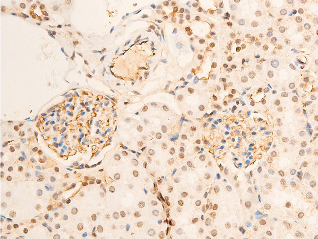 NTRK1 / TrkA Antibody - 1:100 staining mouse kidney tissue by IHC-P. The tissue was formaldehyde fixed and a heat mediated antigen retrieval step in citrate buffer was performed. The tissue was then blocked and incubated with the antibody for 1.5 hours at 22°C. An HRP conjugated goat anti-rabbit antibody was used as the secondary.