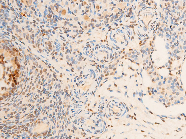 NTRK1 / TrkA Antibody - 1:100 staining rat ovarian tissue by IHC-P. The tissue was formaldehyde fixed and a heat mediated antigen retrieval step in citrate buffer was performed. The tissue was then blocked and incubated with the antibody for 1.5 hours at 22°C. An HRP conjugated goat anti-rabbit antibody was used as the secondary.