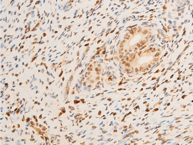 NTRK1 / TrkA Antibody - 1:100 staining rat uterine tissue by IHC-P. The tissue was formaldehyde fixed and a heat mediated antigen retrieval step in citrate buffer was performed. The tissue was then blocked and incubated with the antibody for 1.5 hours at 22°C. An HRP conjugated goat anti-rabbit antibody was used as the secondary.