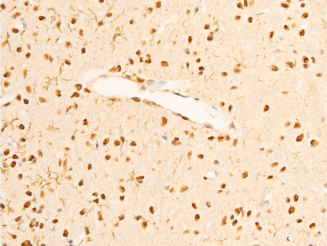 NTRK1 / TrkA Antibody - 1:100 staining rat brain tissue by IHC-P. The tissue was formaldehyde fixed and a heat mediated antigen retrieval step in citrate buffer was performed. The tissue was then blocked and incubated with the antibody for 1.5 hours at 22°C. An HRP conjugated goat anti-rabbit antibody was used as the secondary.