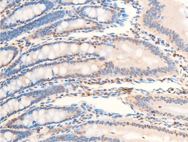 NTRK1 / TrkA Antibody - 1:100 staining rat Intestinal tissue by IHC-P. The tissue was formaldehyde fixed and a heat mediated antigen retrieval step in citrate buffer was performed. The tissue was then blocked and incubated with the antibody for 1.5 hours at 22°C. An HRP conjugated goat anti-rabbit antibody was used as the secondary.