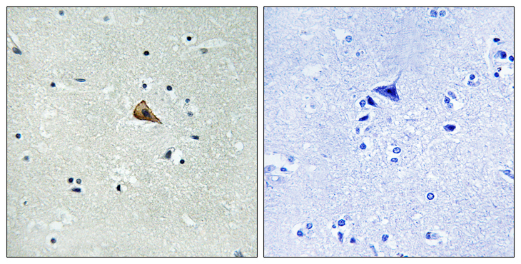 NTRK1 / TrkA Antibody - Immunohistochemistry analysis of paraffin-embedded human brain, using Trk A (Phospho-Tyr701) Antibody. The picture on the right is blocked with the phospho peptide.