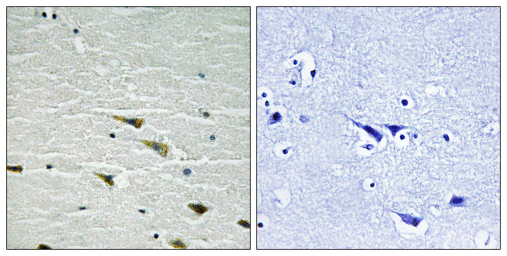 NTRK1 / TrkA Antibody - Immunohistochemistry analysis of paraffin-embedded human brain, using Trk A (Phospho-Tyr757) Antibody. The picture on the right is blocked with the phospho peptide.