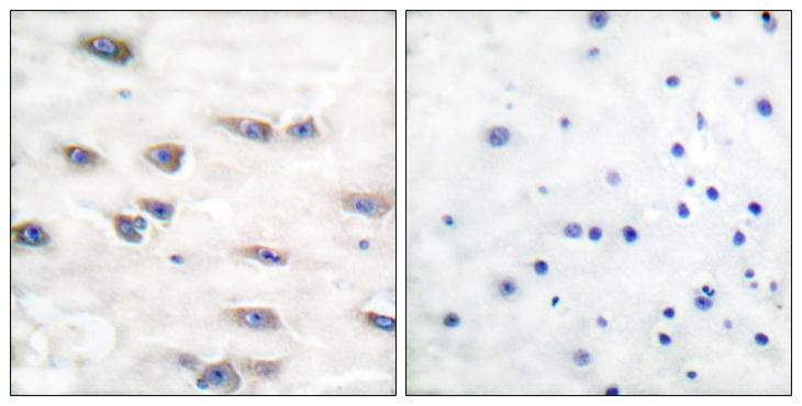 NTRK1 / TrkA Antibody - Immunohistochemistry analysis of paraffin-embedded human brain, using Trk A (Phospho-Tyr791) Antibody. The picture on the right is blocked with the phospho peptide.