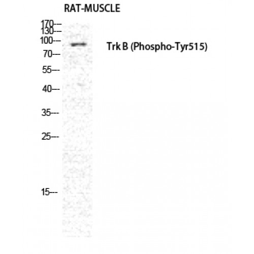 NTRK2 / TRKB Antibody - Western blot of Phospho-Trk B (Y516) antibody