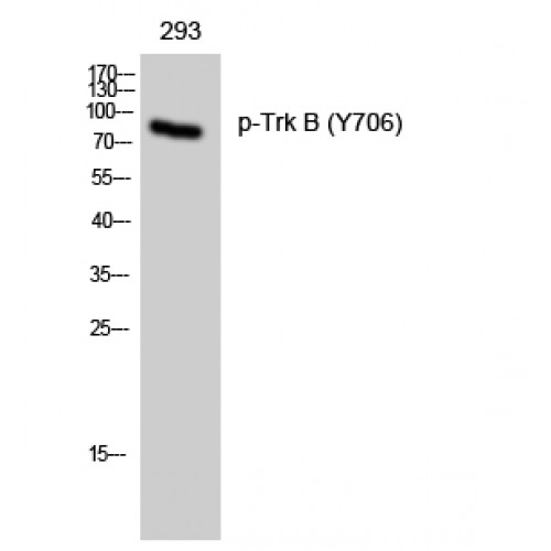 NTRK2 / TRKB Antibody - Western blot of Phospho-Trk B (Y706) antibody